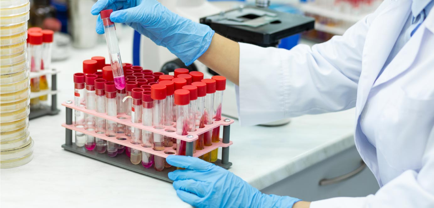 Reactivos más utilizados de Laboratorio, Función, Características y Descripción