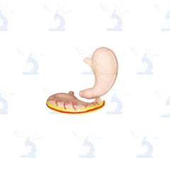 Estomago Gigante. Modelo CVQ7027 Civeq